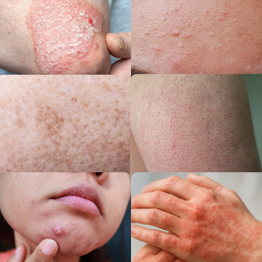 Guide to Spotting + Treating Common Skin Troubles