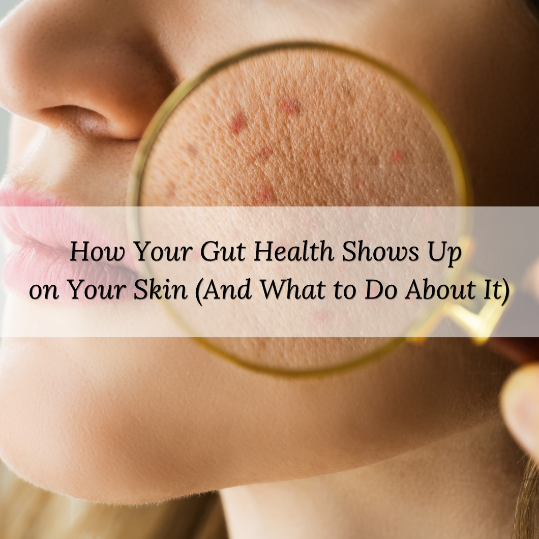How Your Gut Health Shows Up on Your Skin (And What to Do About It)