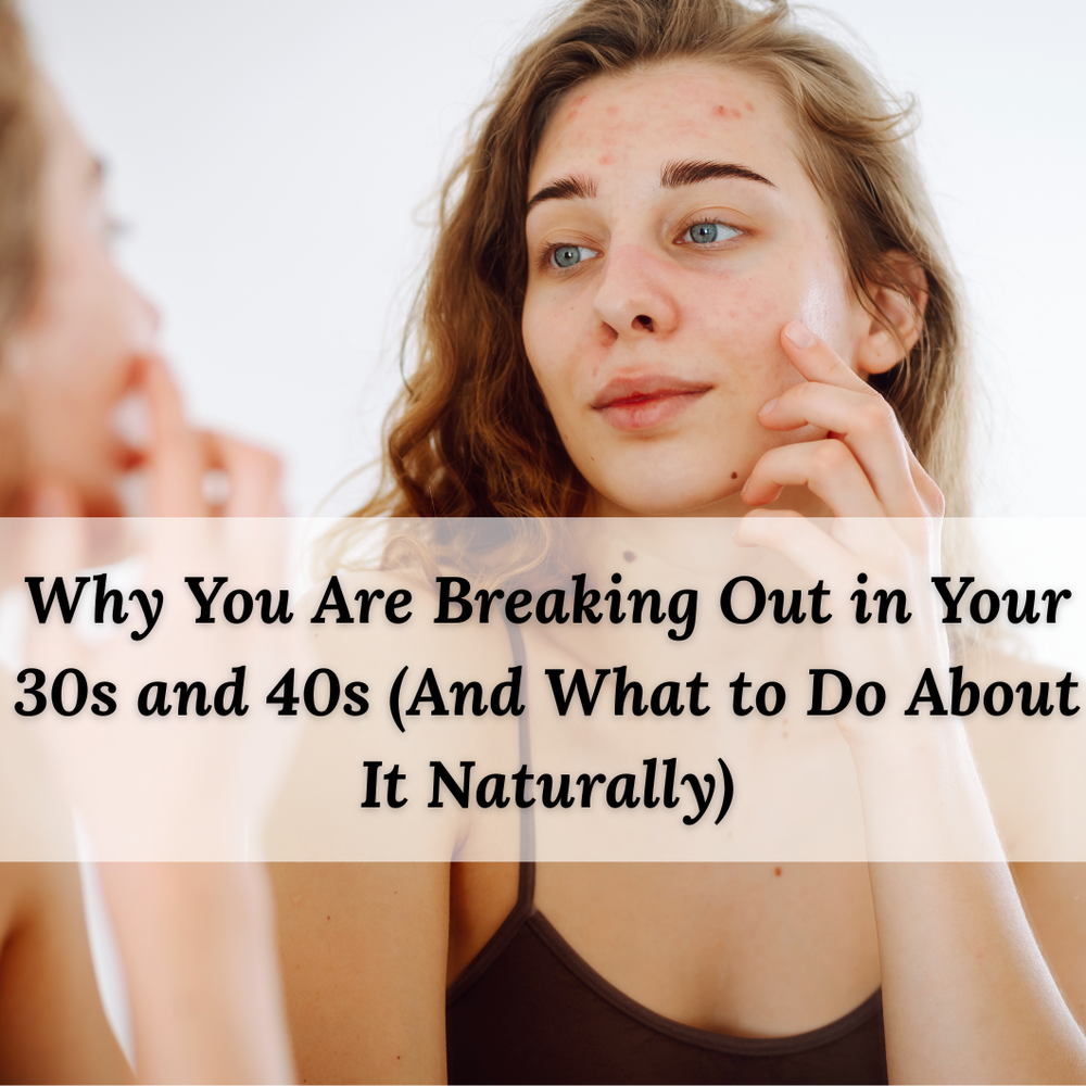 Why You Are Breaking Out in Your 30s and 40s (And What to Do About It Naturally)