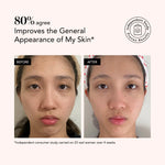 Before and after comparison of a woman's face with text indicating skin improvement.