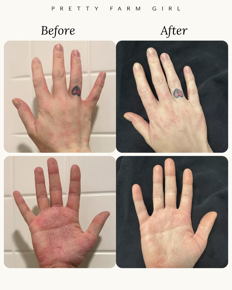 The Soap Skin Solution – Pretty farm girl